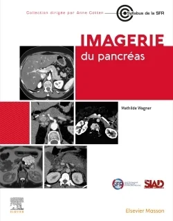 antoineonline9-1345768